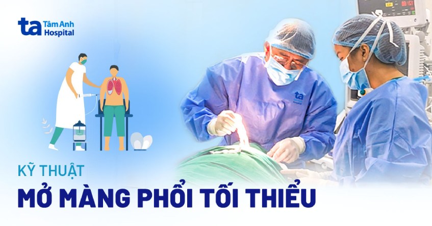 Kỹ thuật mở màng phổi tối thiểu là gì? Khi nào nên lựa chọn?