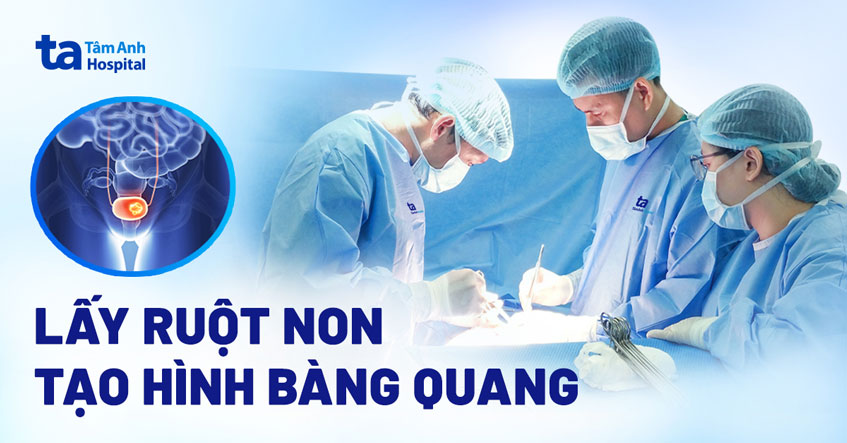 Lấy ruột non tái tạo đường dẫn tiểu sau phẫu thuật cắt bàng quang