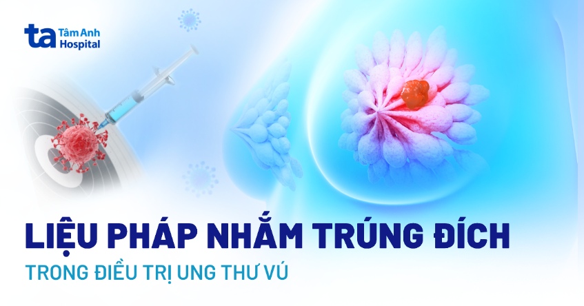 liệu pháp nhắm trúng đích trong điều trị ung thư vú