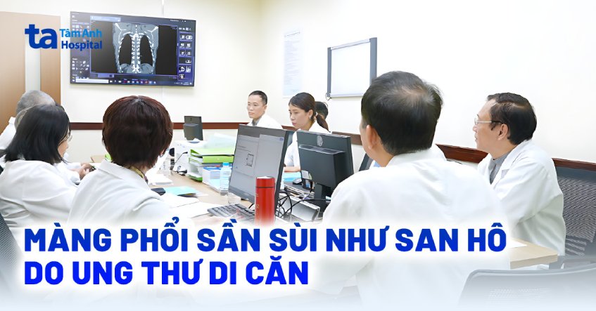 Màng phổi sần sùi như san hô do ung thư di căn
