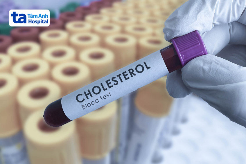 Mẫu máu được đưa đến Trung tâm Xét nghiệm để kiểm tra cholesterol