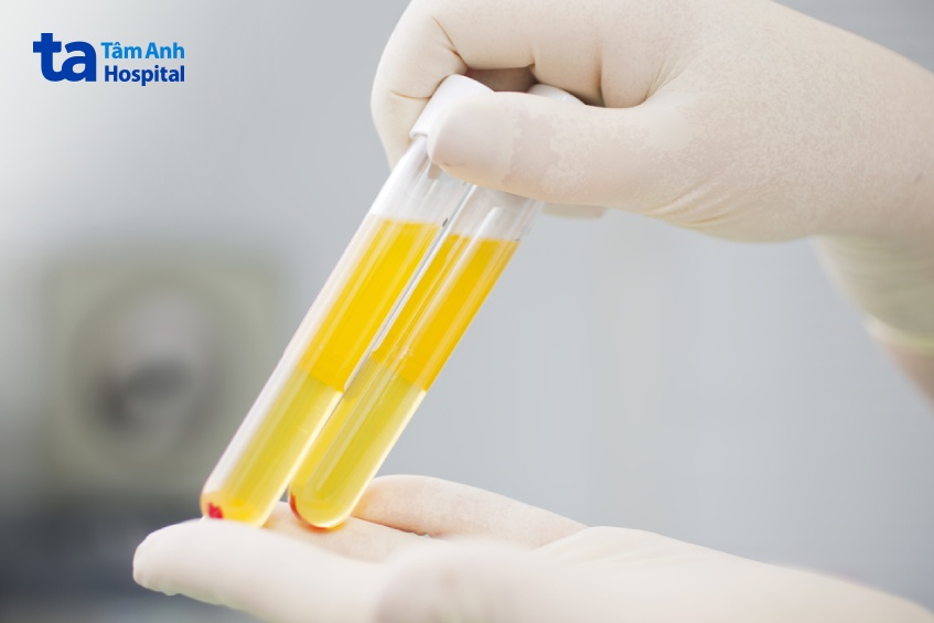 màu sắc của huyết tương