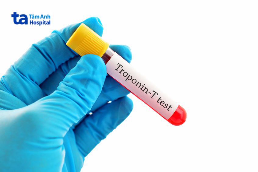 Men tim là chỉ số quan trọng giúp đánh giá tình trạng sức khỏe của tim mạch