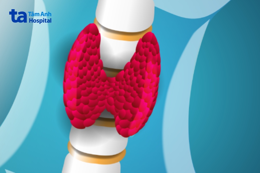 mổ khối ung thư tuyến giáp có nguy hiểm không