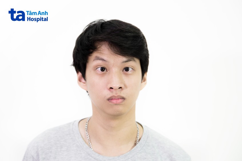 mổ mắt lác có thể tái phát ở những trường hợp đặc biệt
