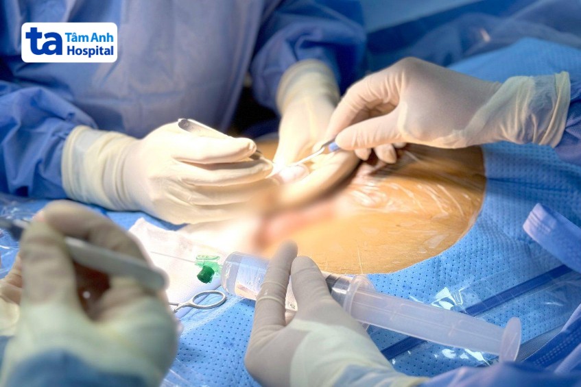 Nam giới vượt mặc cảm chữa vô sinh