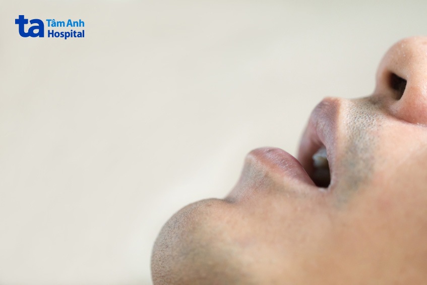 ngủ ngáy lâu ngày