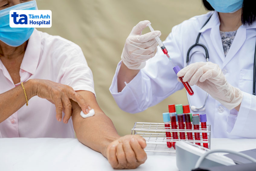 Người trưởng thành từ 20 tuổi trở lên nên xét nghiệm cholesterol định kỳ 5 năm/lần