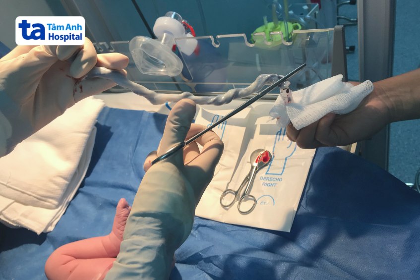 nguồn gốc tế bào gốc đa năng ở trẻ sơ sinh