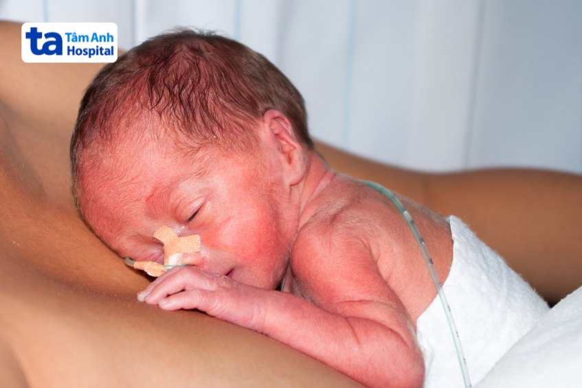 nguy cơ ở em bé sinh non 26 tuần tuổi cần chú ý