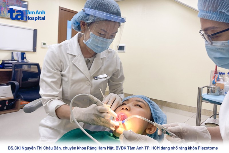 Nhổ răng khôn Piezotome là gì?