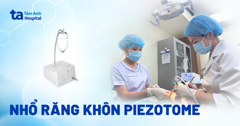nhổ răng khôn Piezotome