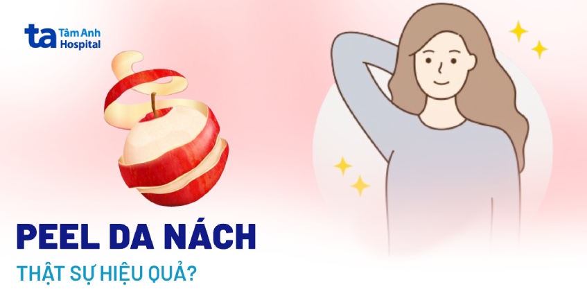 Kỹ thuật peel nách: Giải pháp an toàn và tiện lợi
