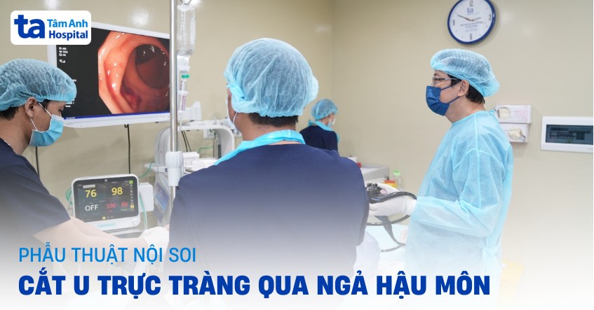 Phẫu thuật nội soi cắt u trực tràng qua ngả hậu môn (TAMIS)