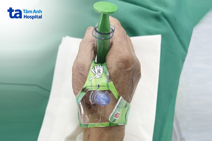 quy trình can thiệp tim mạch