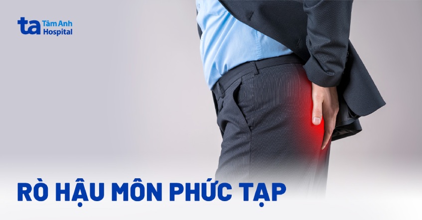 Rò hậu môn phức tạp: Nguyên nhân, triệu chứng, phòng ngừa