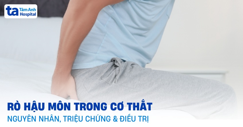 Rò hậu môn trong cơ thắt (Rò dưới da niêm mạc): Chẩn đoán bệnh
