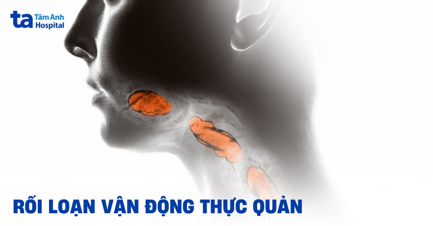 rối loạn vận động thực quản