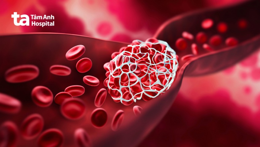 rủi ro biến chứng có thể gặp