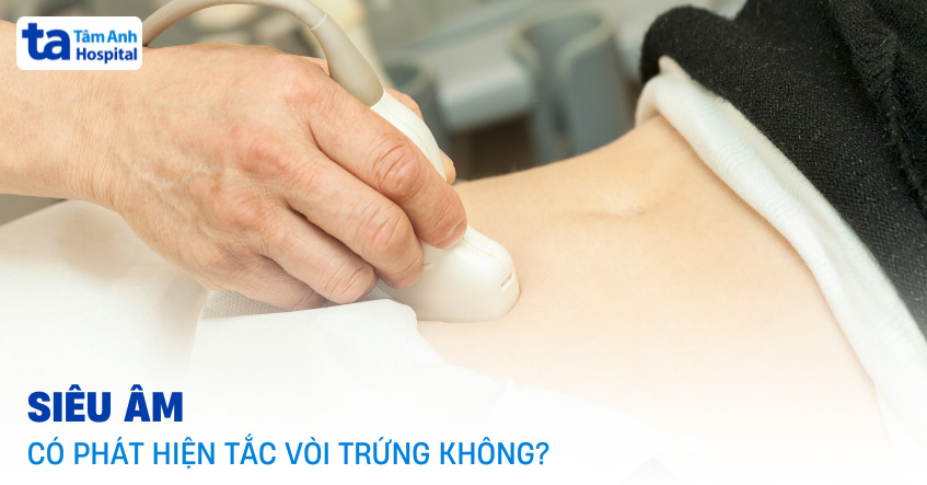 Siêu âm có phát hiện tắc vòi trứng không?