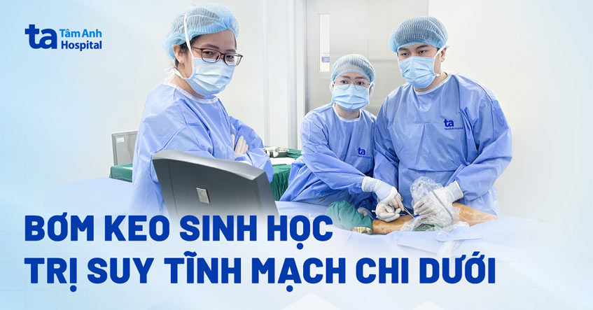 Suy tĩnh mạch sau 30 năm làm nhân viên văn phòng