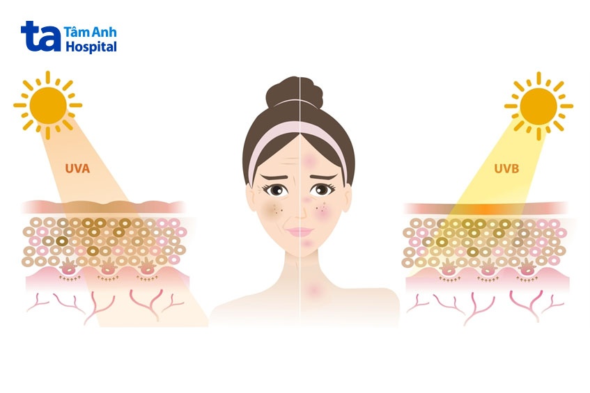 tác hại của tia uv với làn da