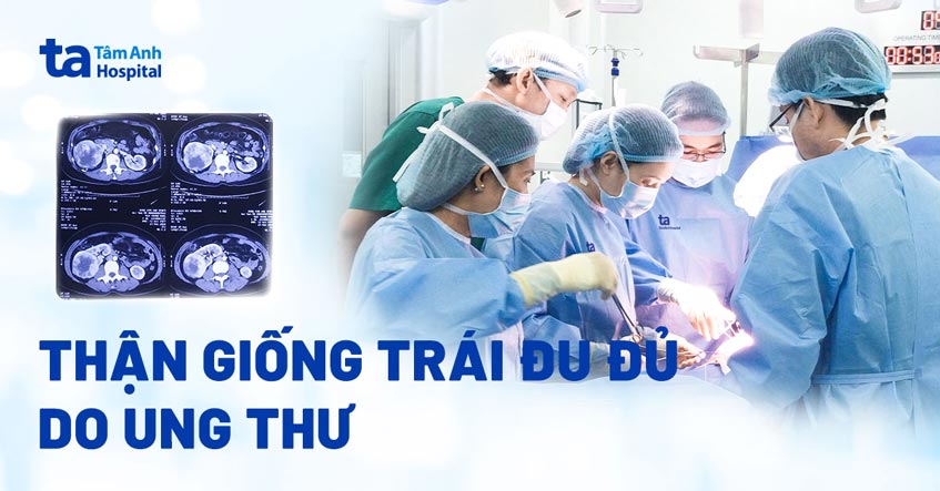 Thận biến dạng như trái đu đủ do ung thư