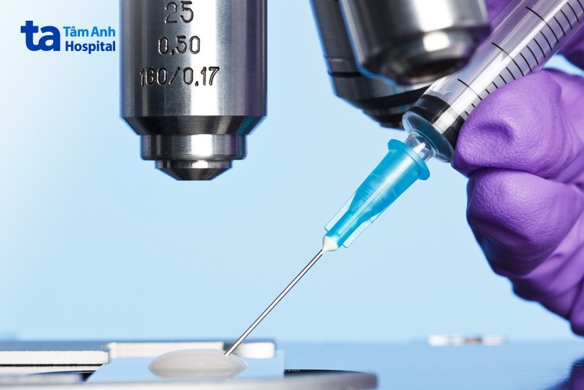 thắt ống dẫn tinh có xuất được không