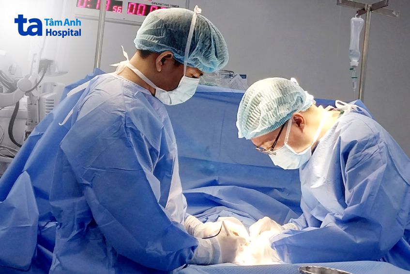 thắt ống dẫn tinh rồi có nối được không