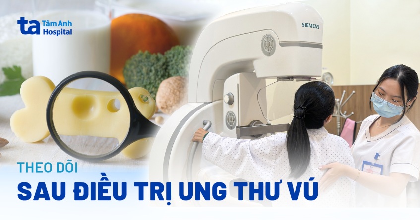 theo dõi sau điều trị ung thư vú