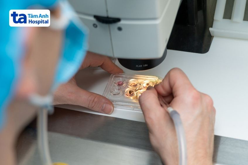 Tinh trùng thu được sau quá trình chọc hút sẽ được kiểm tra sàng lọc