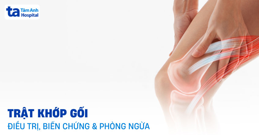 trật khớp gối
