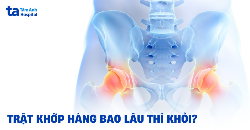Trật khớp háng bao lâu thì khỏi? Có tự hết được không?