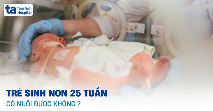 Trẻ sinh non 25 tuần có nuôi được không? Sự phát triển của bé