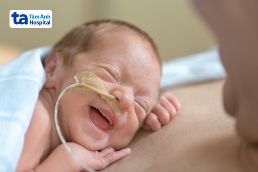 Trẻ sinh non cần nhiều hỗ trợ từ y tế và người thân
