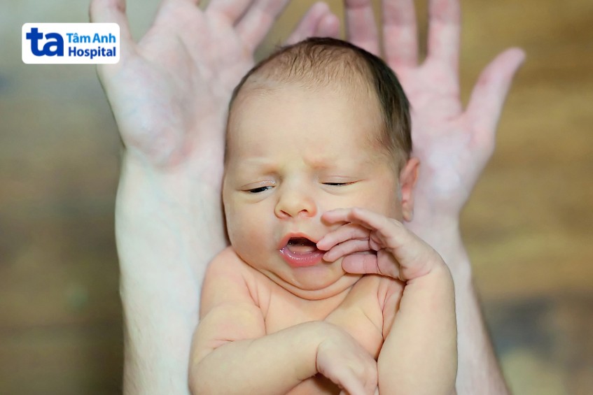 Trẻ vàng da sinh lý biểu hiện sau khoảng 2 đến 4 ngày đầu đời