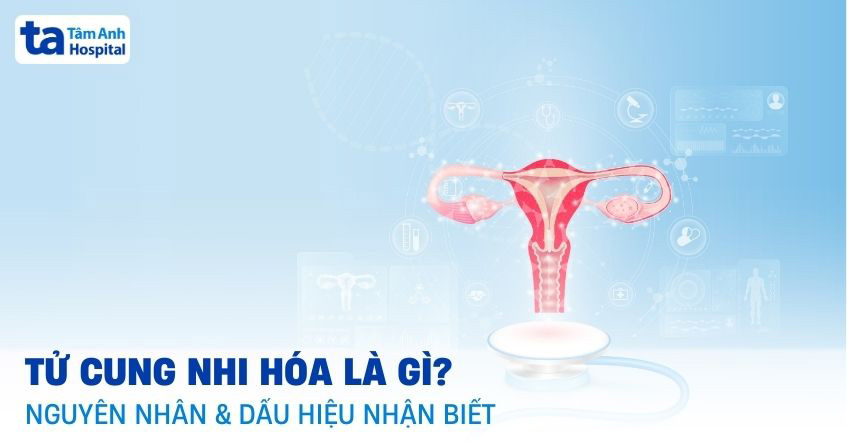 Tử cung nhi hóa: Dấu hiệu, nguyên nhân, chẩn đoán và phòng ngừa