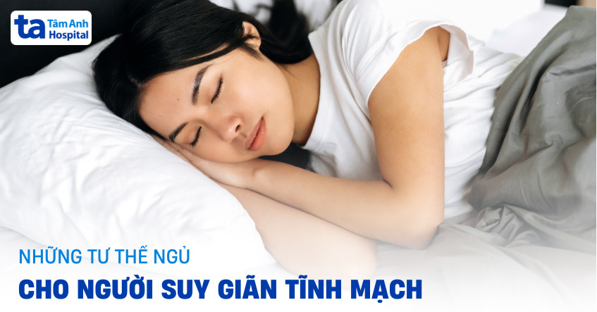 3 tư thế ngủ cho người suy giãn tĩnh mạch đúng cách từ [A-Z]