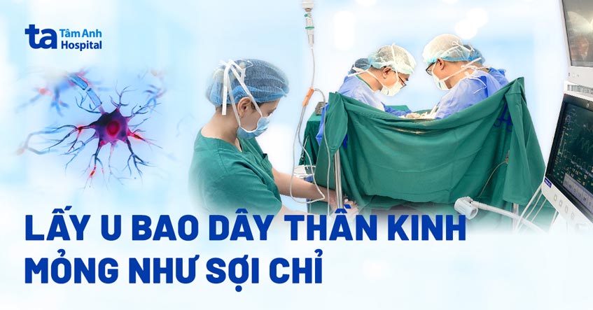 Lấy u bao quanh dây thần kinh mỏng như sợi chỉ