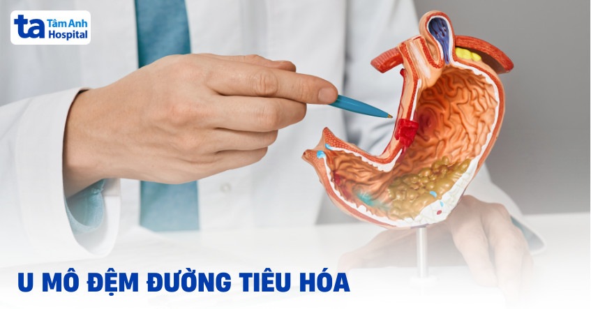 u mô đệm đường tiêu hóa