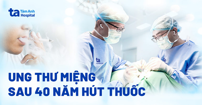 ung thư miệng sau 40 năm hút thuốc