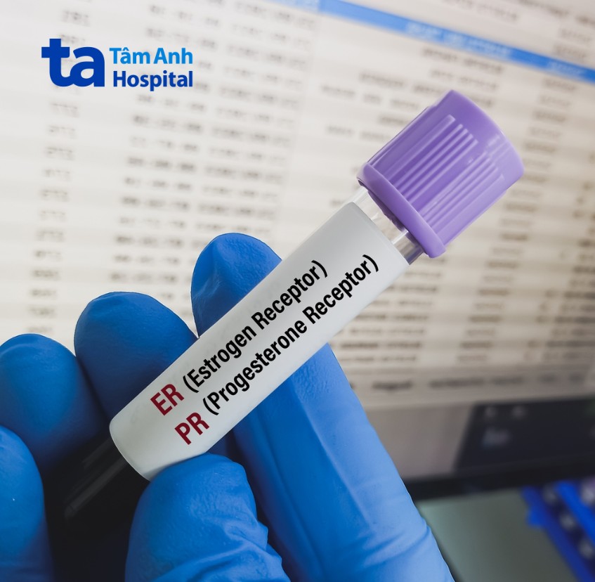 ung thư vú âm tính her2 có nguy hiểm không