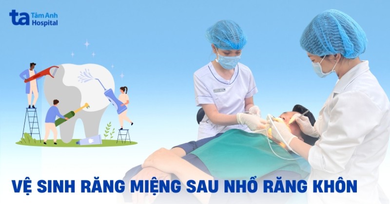 Cách vệ sinh răng miệng sau khi nhổ răng khôn ngăn nhiễm trùng
