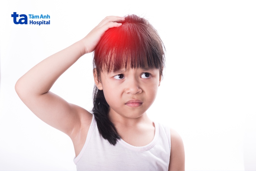 vị trí khối u não ở trẻ em