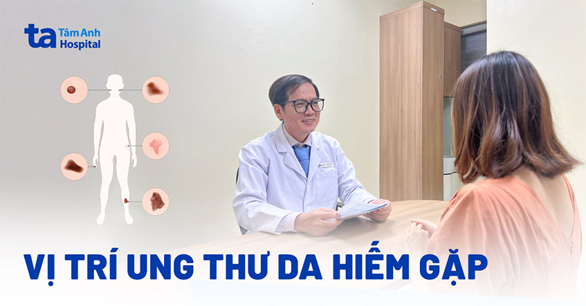10 vị trí ung thư da hiếm gặp bạn cần biết để điều trị kịp thời