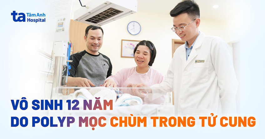 Vô sinh 12 năm do polyp mọc chùm trong tử cung