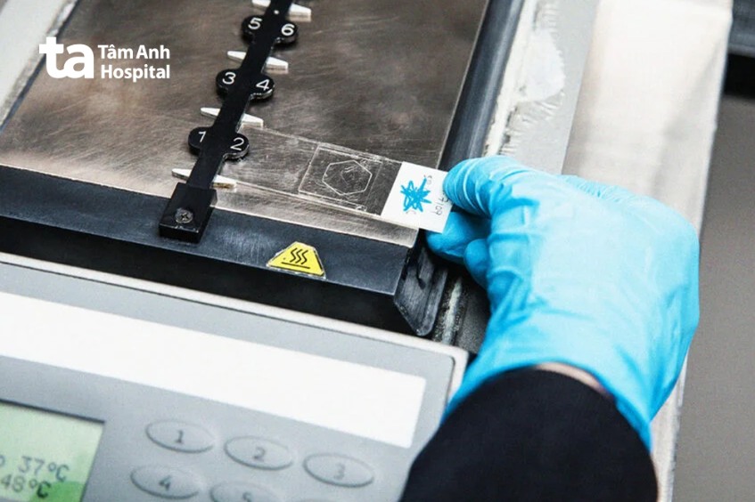 Xét nghiệm lai huỳnh quang tại chỗ FISH