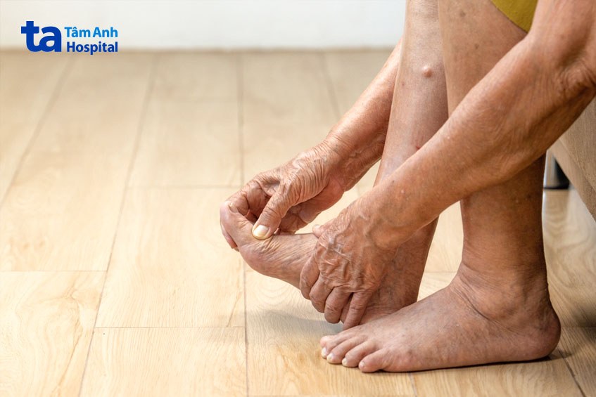 bàn chân tiểu đường khiến vùng da chân người bệnh khô, nứt