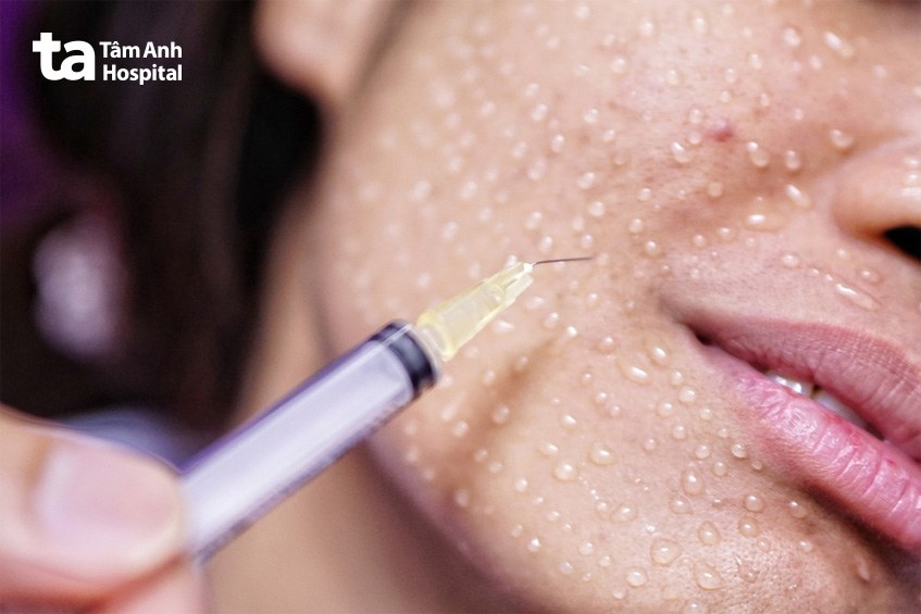 bảng giá chi phí tiêm ha