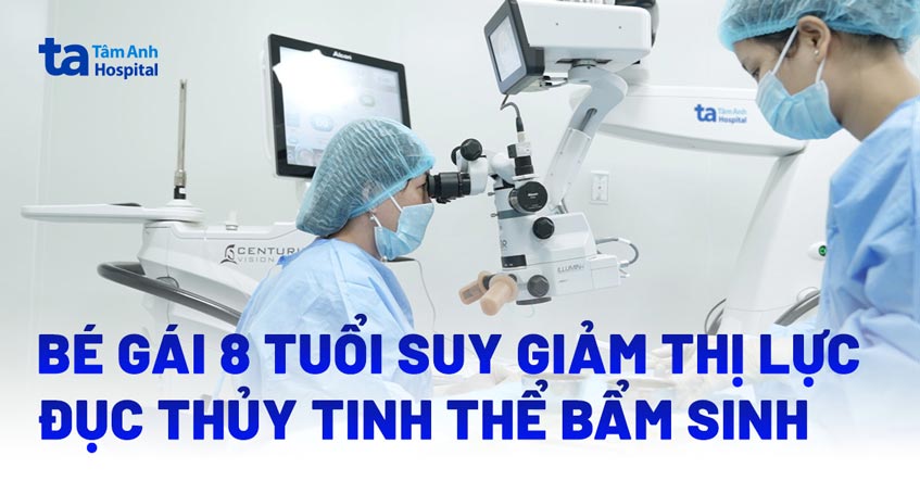 Bé gái 8 tuổi suy giảm thị lực do đục thủy tinh thể bẩm sinh